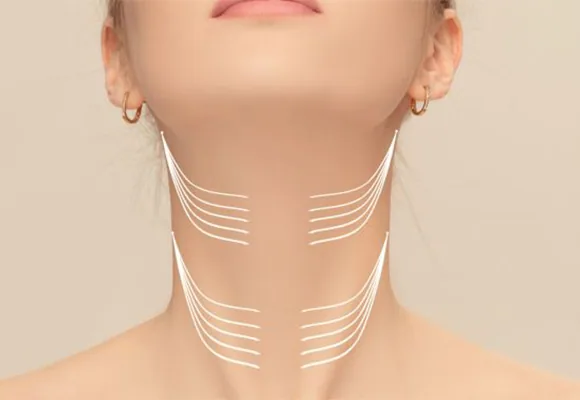 Botox For Neck Lines