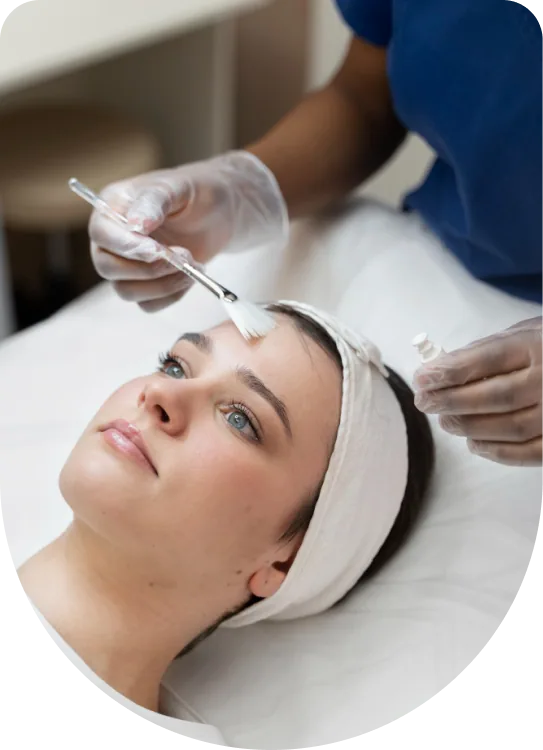 Chemical Peel