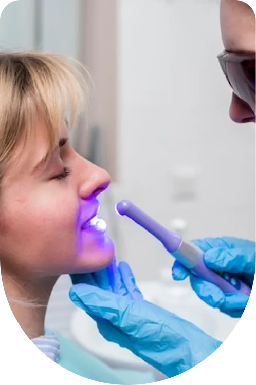 Dental Bonding