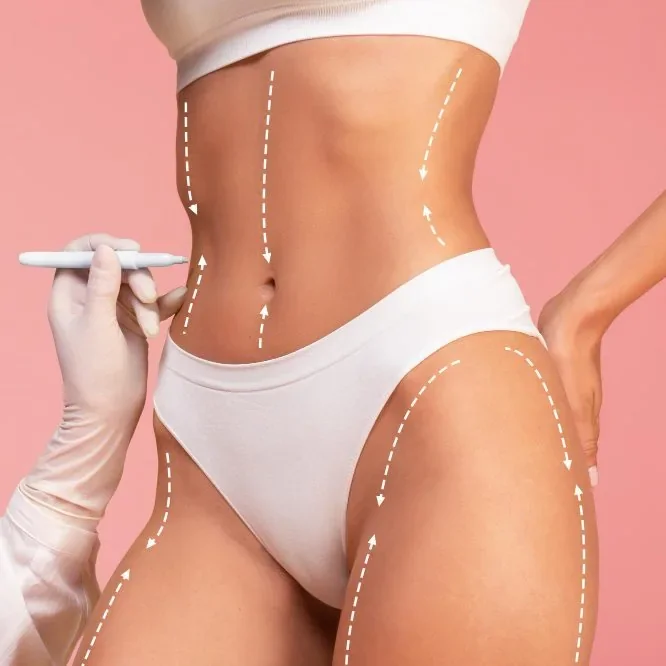 Surgical Treatments